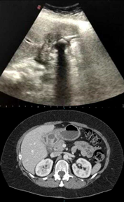 Imagen en blanco y negro de un plato

Descripción generada automáticamente con confianza baja