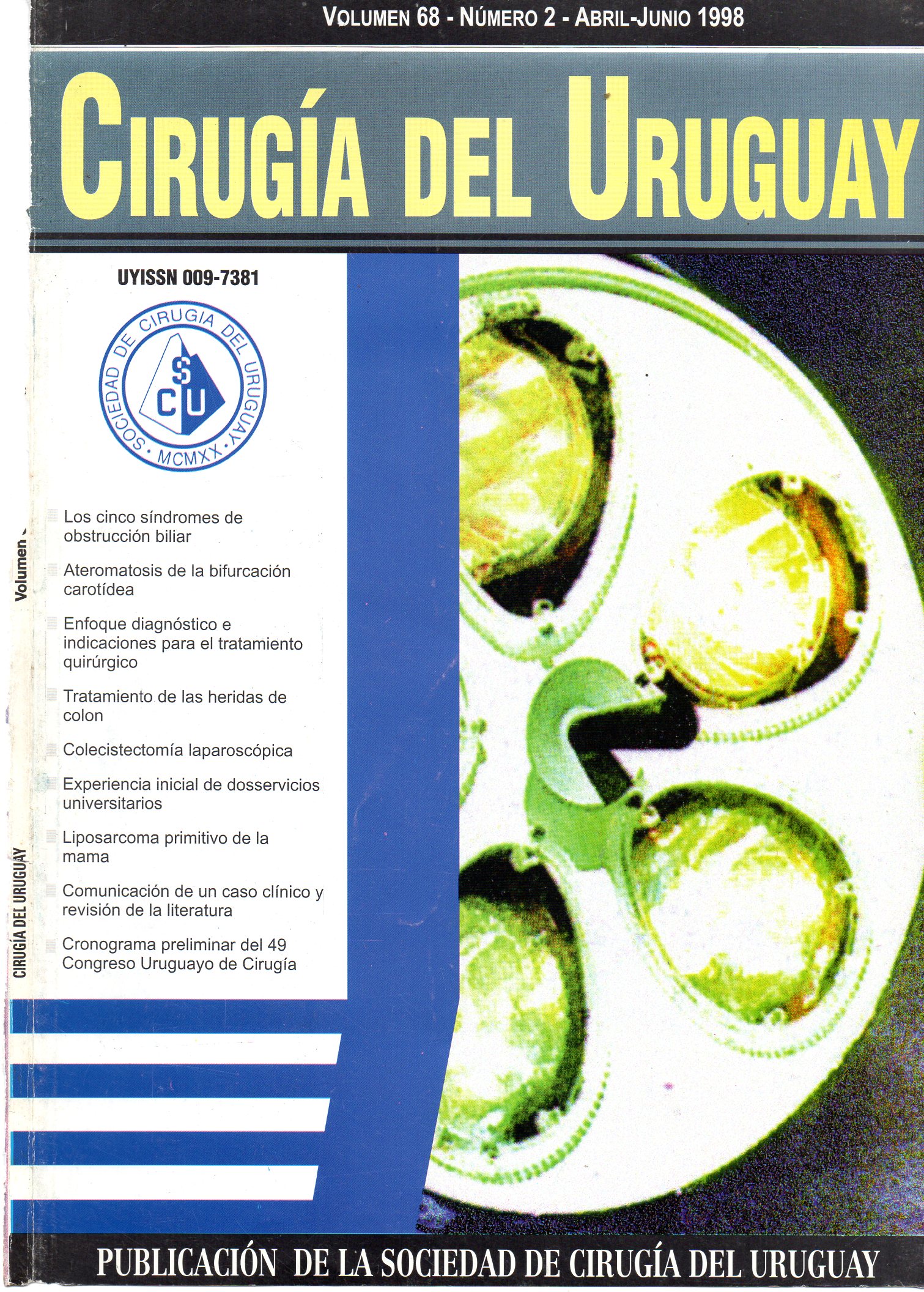 					View Vol. 68 No. 2 (1998): Cirugía del Uruguay
				
