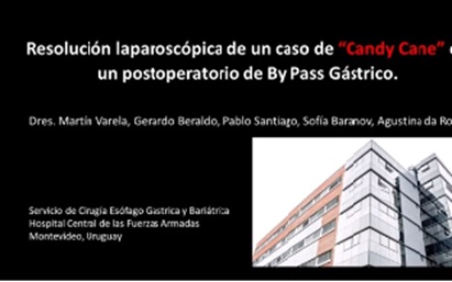 Resolución laparosc´opica...