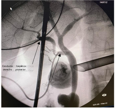 imagen variante anatómica