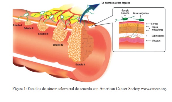 Relato Cáncer de colon