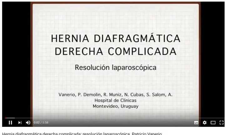 tapa_video_hernia_diafragmática.jpg